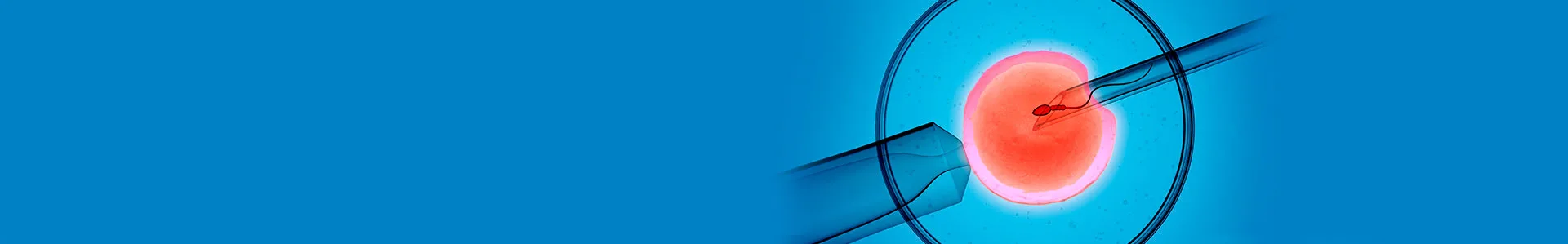 FIV (fertilização in vitro) com ICSI