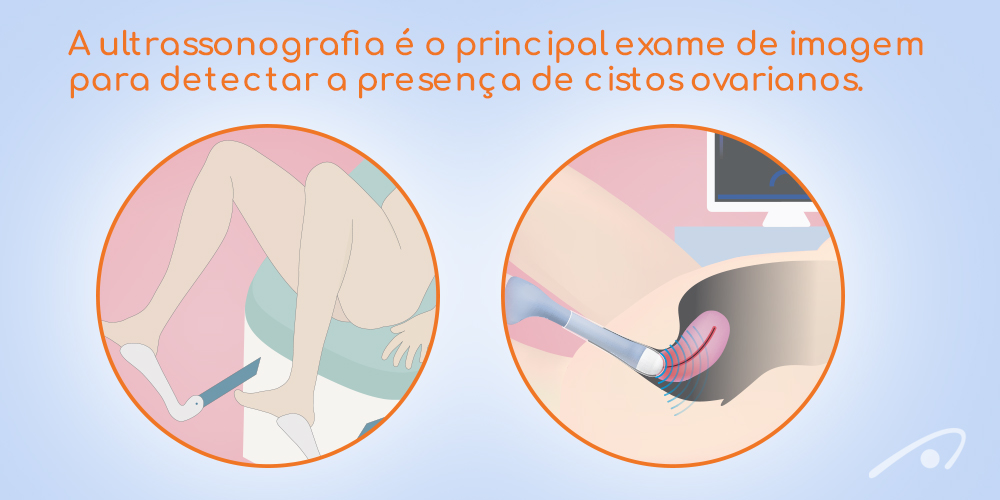 COMO SABER SE A SUA MENSTRUAÇÃO ESTA DESREGULADA ?  Menstruação, Ovários  policísticos, Tratamentos naturais