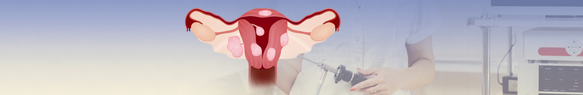 Miomas: veja como é feito o tratamento e as opções em caso de infertilidade