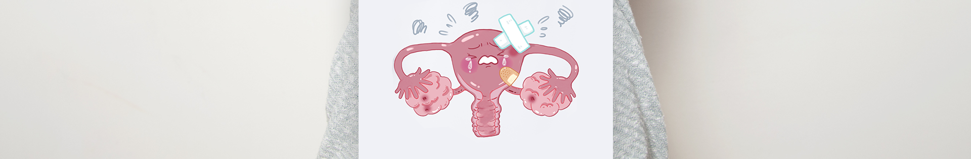 Endometriomas: o que são?