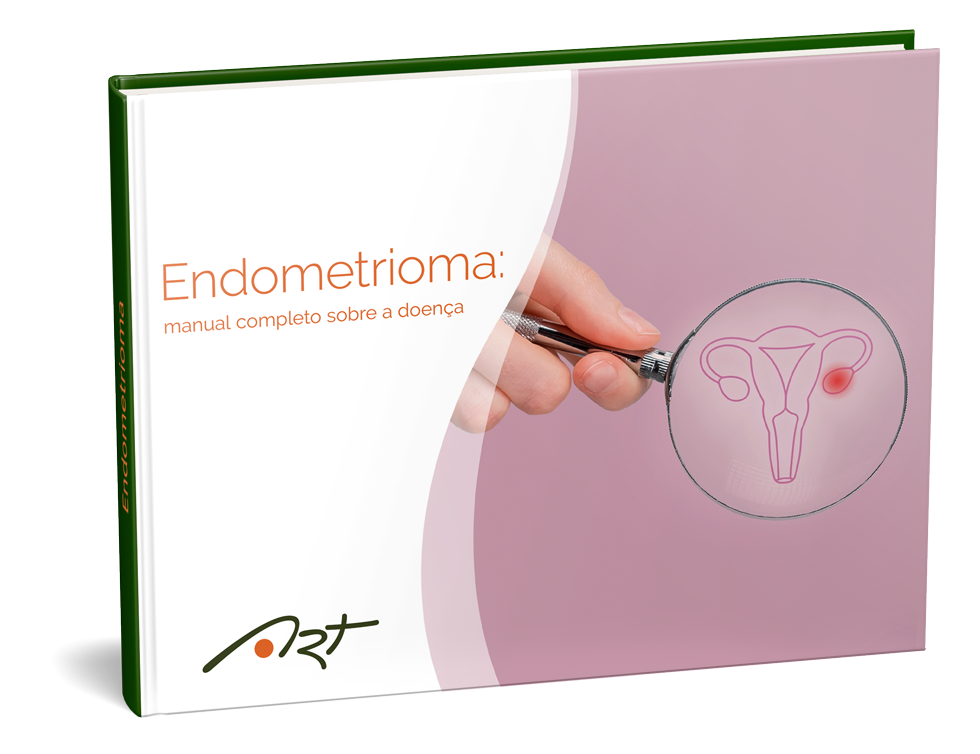 O que é endometrioma?